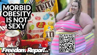 MORBID OBESITY IS NOT SEXY, NOT HEALTHY, AND NOT TO BE CELEBRATED - THE LEFT IS NUTS!
