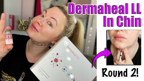 Dissolving Double Chin with Dermaheal LL from Acecosm : Round 2 | Code Jessica10 Saves you Money!