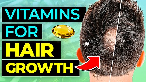 8 BEST Vitamins & Nutrients For Instant HAIR GROWTH