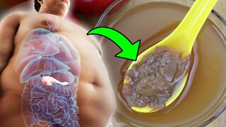 How To Use Apple Cider Vinegar To Lose Weight And Reduce Belly Fat