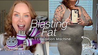 THIS IS MIND BLOWING! 5 In 1 40K Ultrasonic Cavitation Machine #beforeandafter #tutorial #fatloss