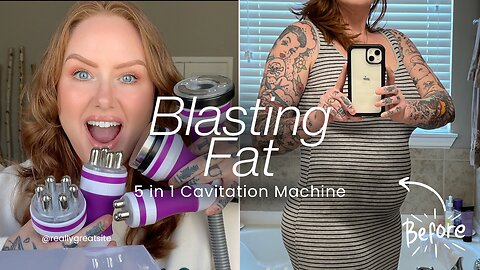 THIS IS MIND BLOWING! 5 In 1 40K Ultrasonic Cavitation Machine #beforeandafter #tutorial #fatloss