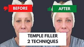 Temple Restoration using Two Techniques