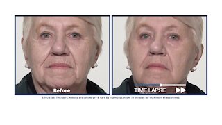 Plexaderm can help you look younger on your video chats!