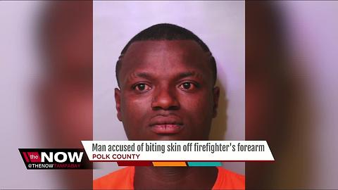 Man bites firefighter, batters police officers