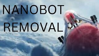 Nanobot Removal-Free Energy Healing Video