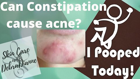 Can constipation cause acne?