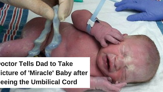 Doctor Tells Dad to Take Picture of ‘Miracle’ Baby after Seeing the Umbilical Cord