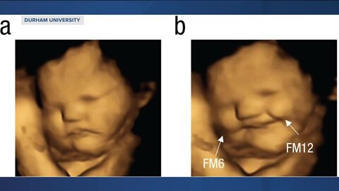 Today's Talker: Carrots vs Kale, does preference start in the womb?