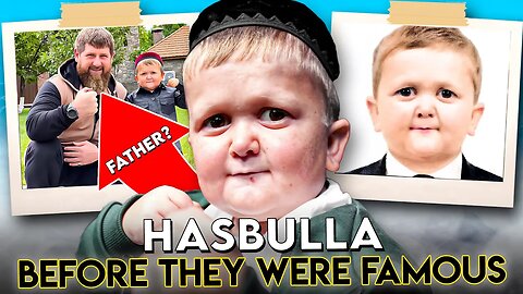 Hasbulla | Before They Were Famous | How Internet Changed His Life?