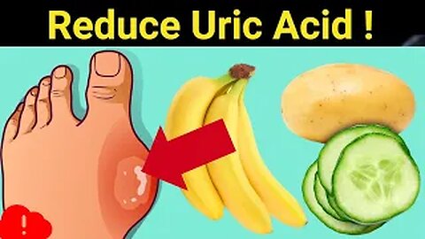 12 Foods That Reduce Your Uric Acid Levels