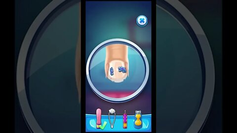 foot doctor care | Foot Surgery Doctor Gameplay Walkthrough | Lazoo games