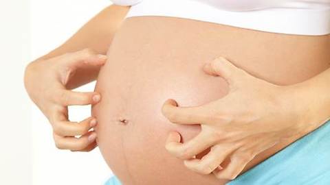 Reduce Itch For Pregnant Women