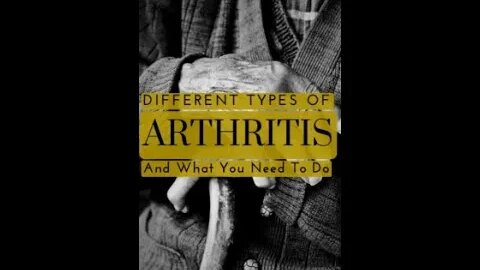 Arthritis