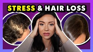 HOW STRESS COULD BE CAUSING YOUR HAIR LOSS | How to combat hair loss from stress!