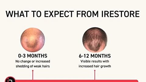 iRestore Essential Laser Hair Growth System - FDA Cleared Hair Growth for Men & Hair Loss Treatments