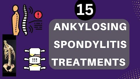 15 ankylosing spondylitis treatments