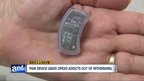 EXCLUSIVE: Electrical pain device successfully guides patients through heroin withdrawal