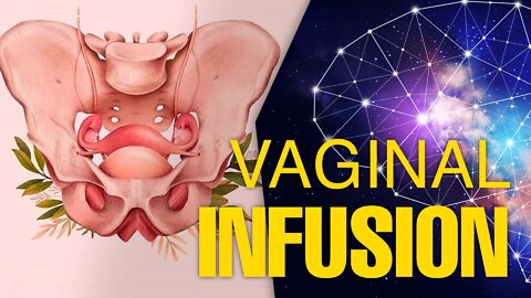 Vaginal infusion - LIVE Q&A