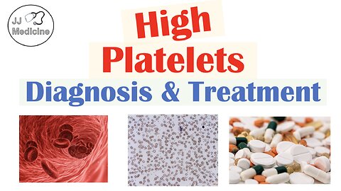 What is Thrombocytosis? Diagnosis & Treatment of High Platelets | Rapid Review