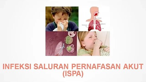 Infeksi Saluran Pernapasan Akut (ISPA) Acute Respiratory infections