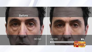 Watch Signs of Aging Disappear in Minutes