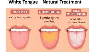 White Tongue - Natural Treatments & Causes