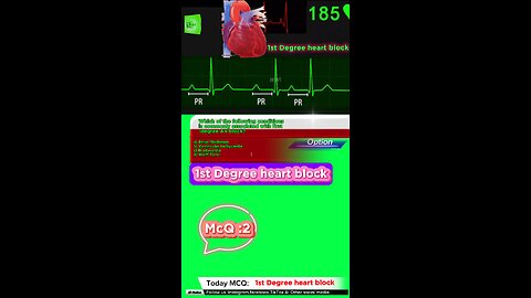 First degree heart blockages #firstdegreeavblock #arrthymias #CardiacArrhythmia #Cardiology