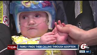 Family finds their calling through adopting special needs children
