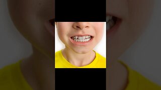 How To Whiten Teeth In Photoshop #mcd #mcddesigner #shorts #short #photoshop_tutorial