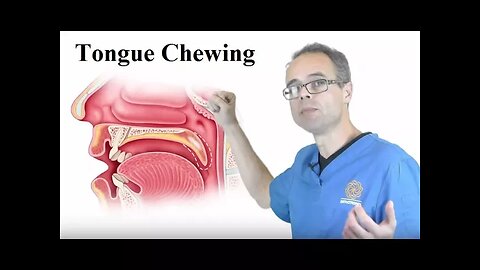 Tongue Chewing By Dr Mike Mew