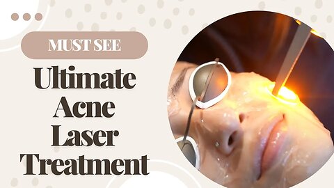 The Best Acne Scar Laser Treatment! | Barrett MedSpa