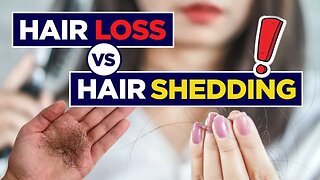 Hair Loss vs Hair Shedding (Do You Have Hair Loss?) + Home Remedies