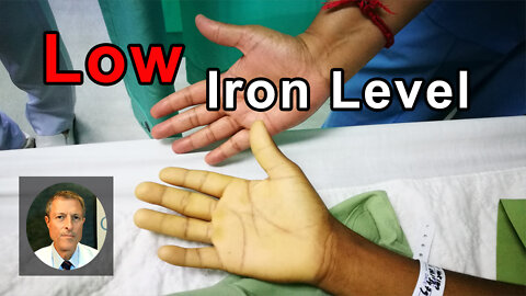 Why Am I Having A Low Iron Level? - Neal Barnard, MD
