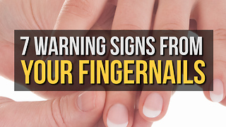 7 Warning Signs from Your Fingernails