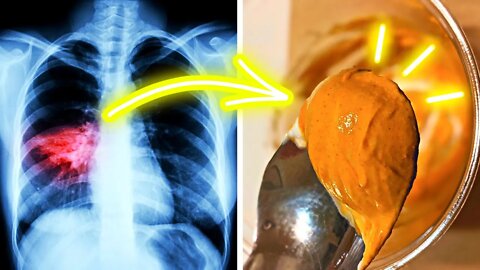 Turmeric Jelly: A Miraculous Remedy To Treat Respiratory Diseases