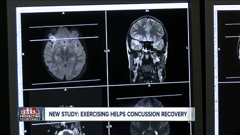 Have you been concussed? New study recommends a new way to recover
