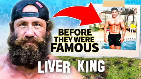 Liver King | Before They Were Famous | Why He Eating Testicles For Fame?