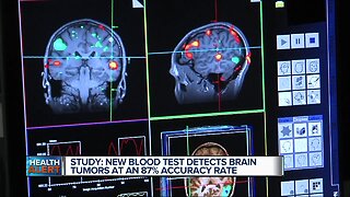 New blood test detects brain tumors with 87% accuracy