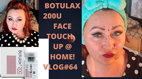 BOTULAX 200U FACE TOUCH UP @ HOME! . VLOG#64 2.13.22
