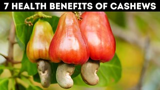 7 Health Benefits of Eating Cashews