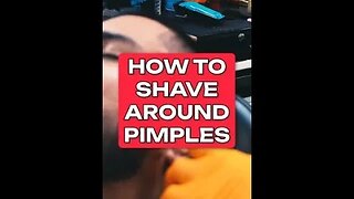 how to shave around pimples