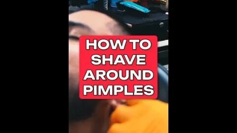 how to shave around pimples