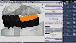 Part 2: Making a Hybrid from a Denture