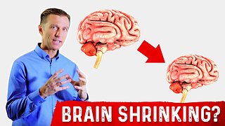 High Blood Sugar leads to Smaller Brains – Dr.Berg's Tips to Regenerate Brain