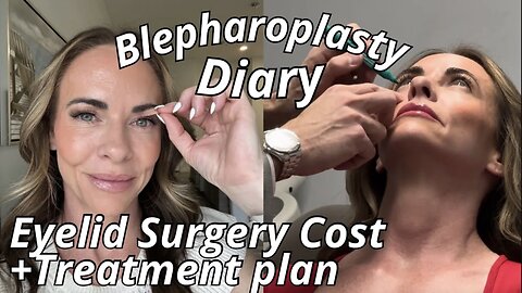 Exploring Blepharoplasty Surgery Costs 2024 | Three Price Breakdowns