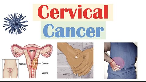 Cervical Cancer: Risk Factors, Pathophysiology, Symptoms, Staging, Diagnosis, Treatment & Prevention