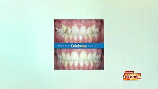 Affordable Braces Worth Smiling About