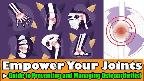 Empower Your Joints A Guide to Preventing and Managing Osteoarthritis