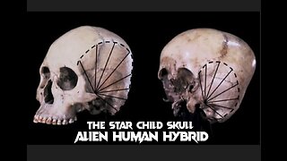 ALIEN HUMAN HYBRID - THE STARCHILD SKULL DNA RESULTS